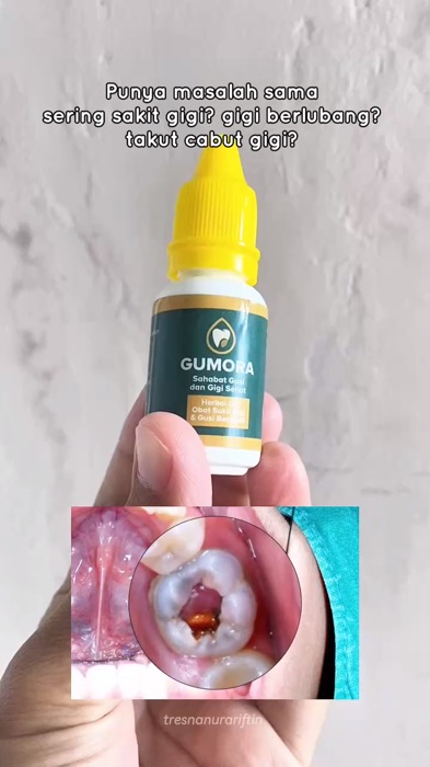#gumora#GUMORAHerbal#obatsakitgigi#obatsakitgigiampuh#obatsakitgigiberlubang#ViralDiShopeeVideo#ShopeeCOD#PromoNonStop#GratisOngkirRP0#RacunShopee
