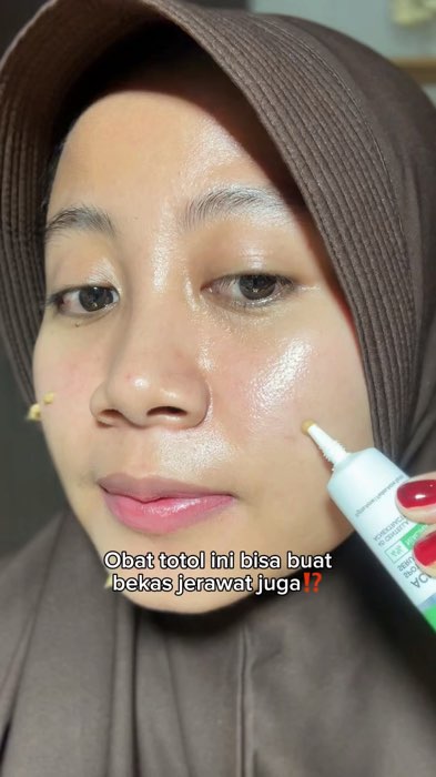 totol jerawat legend, bikin jerawat sama bekasnya hempas😍 #totoljerawatampuh #youacnespotcare #youacneplus #totoljerawat #DiskonRacunShopee