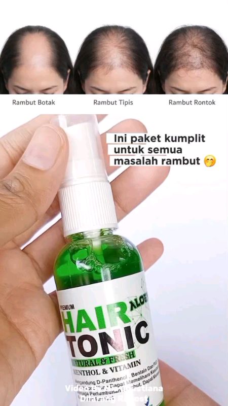 Hair tonic #RacunShopee #DiskonShopeeVideo #fypシ #hairtonic #hair #haircare #hairtonicviral #penumbuhrambut #rambutrontok #vitaminrambut #rambutsehat