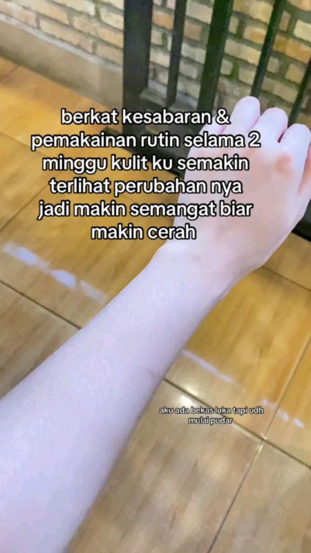 #mencerahkankulit #mencerahkankulitkusam #lotionpencerah #viralvideo #hbdostingoriginal #fypdooonggggggg
