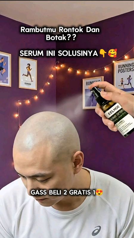 penumbuh rambut cepat #ViralDiShopeeVidio #RacunShopee #penumbuhrambut #penumbuhrambutsecaracepat  #penumbuhrambut