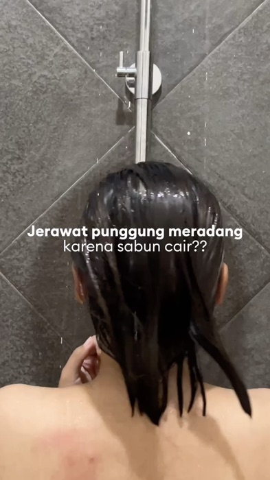 Pake GDL biar jerawat punggung gak semakin meradang #thebathbox #tbbreview #jerawatpunggung #jerawat #gdl