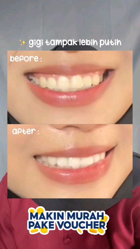 #ShopeeCOD #SpillBawaBerkah #SpillRacunShopee #Cashback40Persen #ViralDiShopeeVideo #Cashback50RB #metoo #metooofficial #metootoothpowder