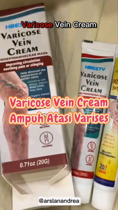 Varicose Vein Cream #varises #creamvarises #obatvarises #DiskonRacunShopee #SpillRacunShopee #RacunShopee