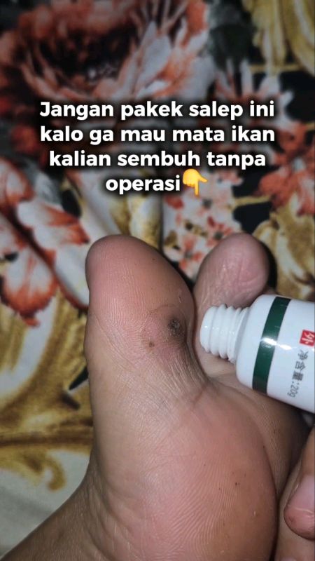 wajib punya #mataikanmeresahkan #salepmataikan #viralvideo #RacunShopee