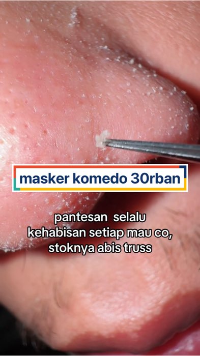 buruan cobain stok menipis #feali #maskerkomedoampuh #maskerkomedobpom #maskerkomedoviral