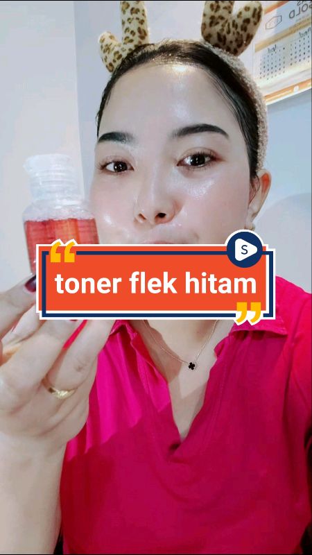 toner flek hitam strong#tonerflekhitam #tonerwajah #RacunShopee #SpillRacunShopee