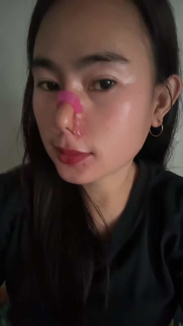 ゚viral #rekomendasi #noseup #pemancunghidung #pemancunghidungalami #pemancunghidungtanpaoplas #lewatberandafyp #fyp #fyppppppppppppppppppppppp