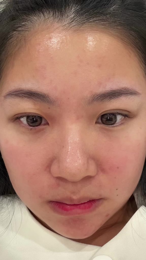 kulit diumur hampir 30.... kuncinya skincare yang tepat🤓 #drleo #drleoid #drleowhitening #skincareindonesia #whitening
